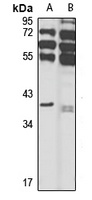 HPR Rabbit Polyclonal Antibody