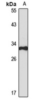 TIP30 Rabbit Polyclonal Antibody