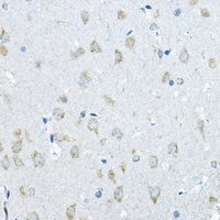 IDS Rabbit Polyclonal Antibody