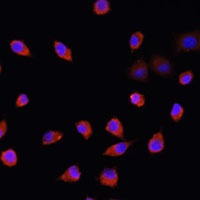 IFT88 Rabbit Polyclonal Antibody