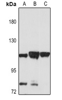 IGHMBP2 Rabbit Polyclonal Antibody