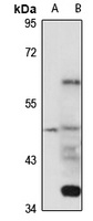 VSIG3 Rabbit Polyclonal Antibody