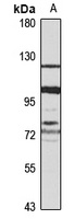 IGSF3 Rabbit Polyclonal Antibody