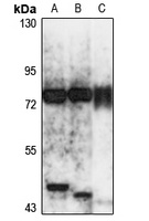 IL-17RE Antibody