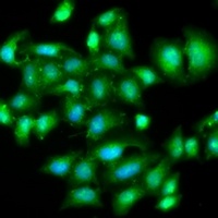 IL-20 Antibody