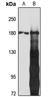 IQGAP2 Rabbit Polyclonal Antibody