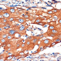IQGAP2 Rabbit Polyclonal Antibody