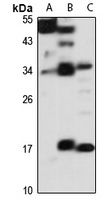 ITM2B Antibody