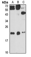 ITPase Antibody