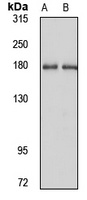 ITSN2 Rabbit Polyclonal Antibody