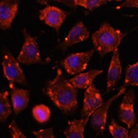 ITSN2 Rabbit Polyclonal Antibody