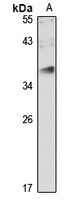 JAM3 Rabbit Polyclonal Antibody