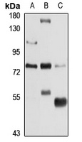 Junctophilin-4 Rabbit Polyclonal Antibody