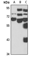 KBTBD7 Rabbit Polyclonal Antibody