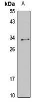 KCNE4 Rabbit Polyclonal Antibody