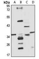 KCHIP1 Rabbit Polyclonal Antibody