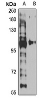 KDM4B Rabbit Polyclonal Antibody
