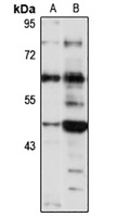 KIAA0513 Rabbit Polyclonal Antibody
