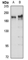 KIAA1429 Rabbit Polyclonal Antibody