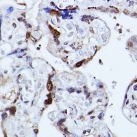 KIAA1429 Rabbit Polyclonal Antibody