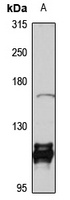 KIF16B Rabbit Polyclonal Antibody