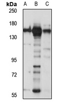 KIF1C Rabbit Polyclonal Antibody