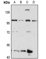 KIF20A Rabbit Polyclonal Antibody