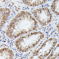 KIF22 Rabbit Polyclonal Antibody