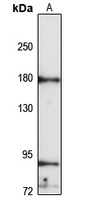 KIF7 Rabbit Polyclonal Antibody