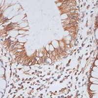 KIFC1 Antibody