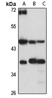 KIN17 Rabbit Polyclonal Antibody