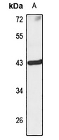 KLHDC3 Rabbit Polyclonal Antibody