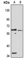 KLHL13 Rabbit Polyclonal Antibody