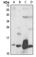KLRC4 Rabbit Polyclonal Antibody