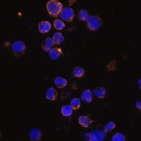KLRC4 Rabbit Polyclonal Antibody