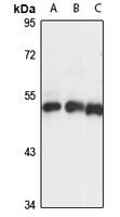 KRR1 Rabbit Polyclonal Antibody