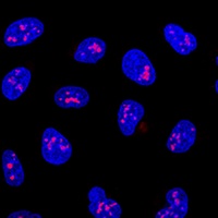 KRR1 Rabbit Polyclonal Antibody