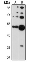 Cytokeratin 36 Rabbit Polyclonal Antibody