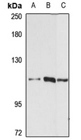 LARP2 Rabbit Polyclonal Antibody