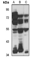 LARP6 Rabbit Polyclonal Antibody