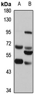 Legumain Rabbit Polyclonal Antibody