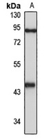 LHX2 Rabbit Polyclonal Antibody