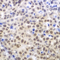 LHX4 Rabbit Polyclonal Antibody