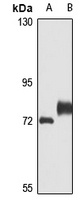 Limd1 Rabbit Polyclonal Antibody