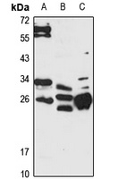 LIN7A Rabbit Polyclonal Antibody