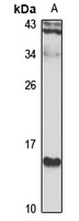 LMO1 Rabbit Polyclonal Antibody