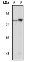 LNX2 Rabbit Polyclonal Antibody
