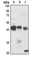 Leupaxin Rabbit Polyclonal Antibody