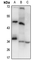 LSAMP Rabbit Polyclonal Antibody