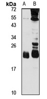 LSM12 Rabbit Polyclonal Antibody